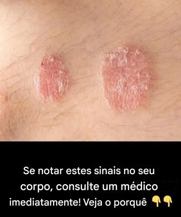 Se você notar estes sinais em seu corpo, consulte um médico imediatamente