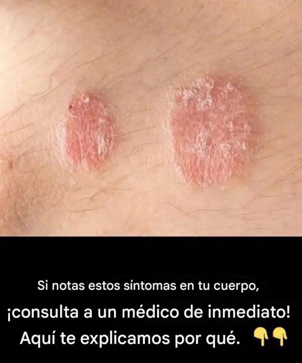 Si nota estas señales en su cuerpo, consulte a un médico de inmediato.