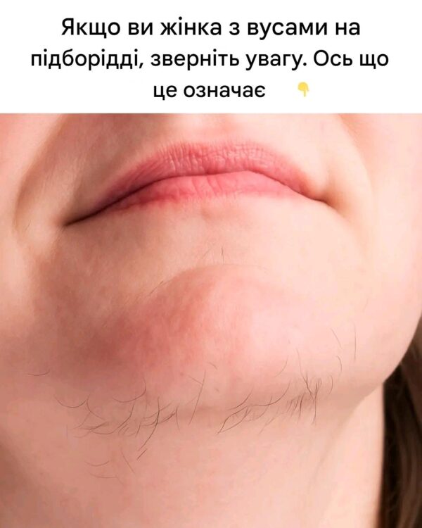 Розуміння та лікування вусів на підборідді у жінок: причини, наслідки та рішення