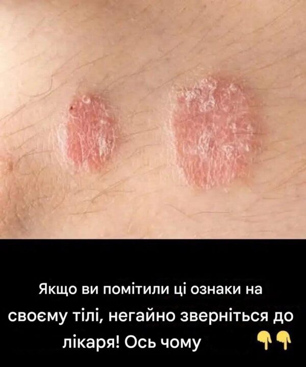 Якщо ви помітили ці ознаки на своєму тілі, негайно зверніться до лікаря