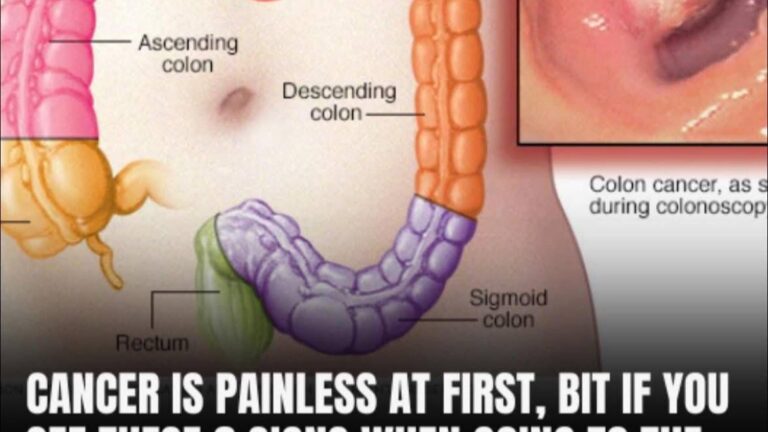 Poop and Colon Cancer: Warning Signs To Look For And When To Seek For Help