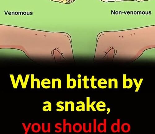 When bitten by a snake, you should do these things first