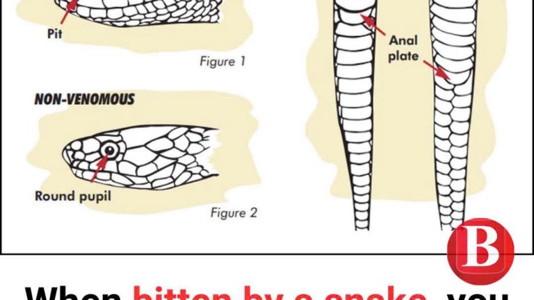 Snake bite signs and first aid you need to know