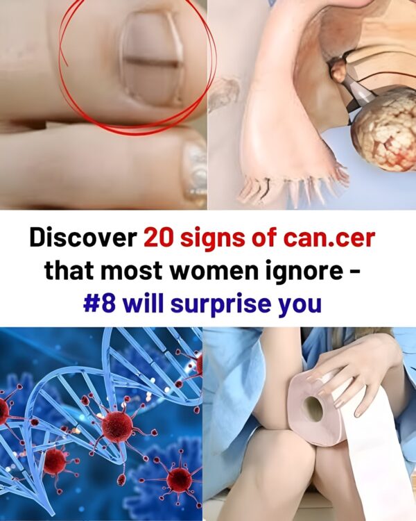 20 Subtle Cancer Symptoms That Are Commonly Missed by Women and Men