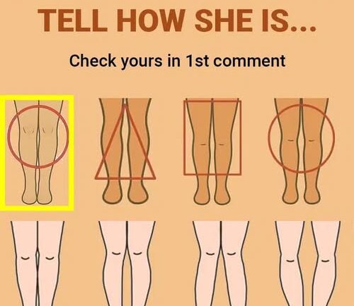 What can your legs reveal about your health?