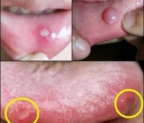 🚨BE VERY CAREFUL . If you get this, you are infected with …. See more