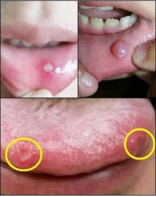 🚨BE VERY CAREFUL . If you get this, you are infected with …. See more