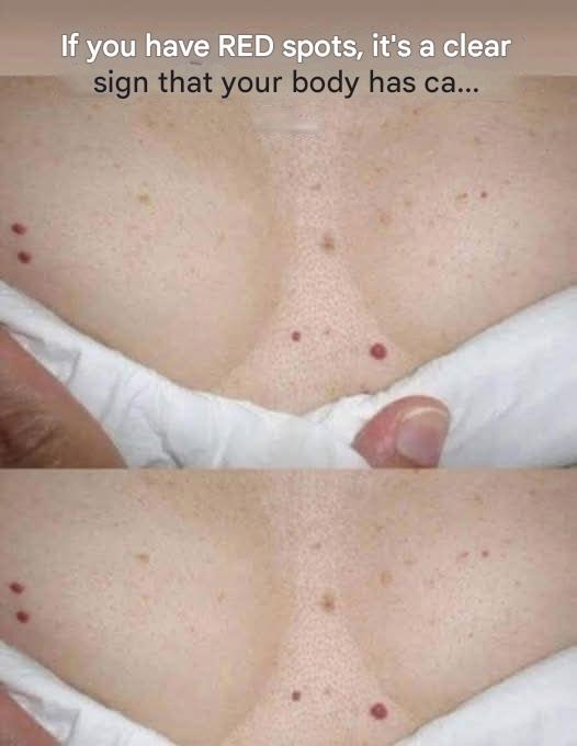 What are the red spots that appear on the skin?