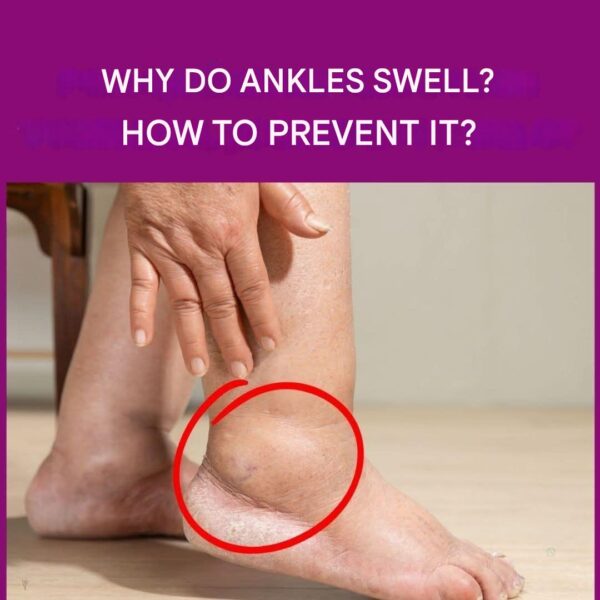 This is the only remedy capable of reducing fluid retention in just 30 minutes.