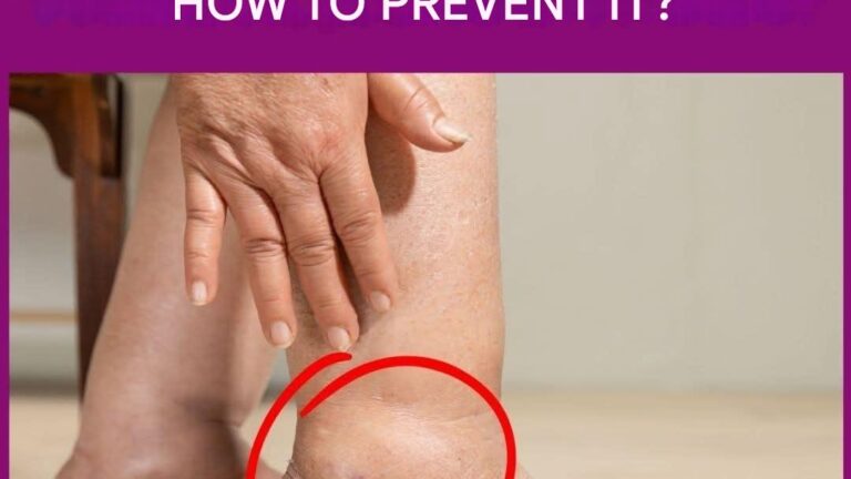 This is the only remedy capable of reducing fluid retention in just 30 minutes.