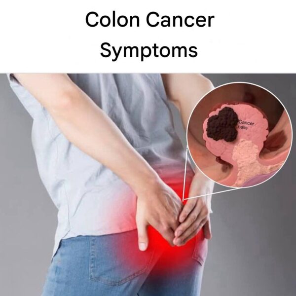 Colon Cancer: Why Is It Affecting More and More Young People?