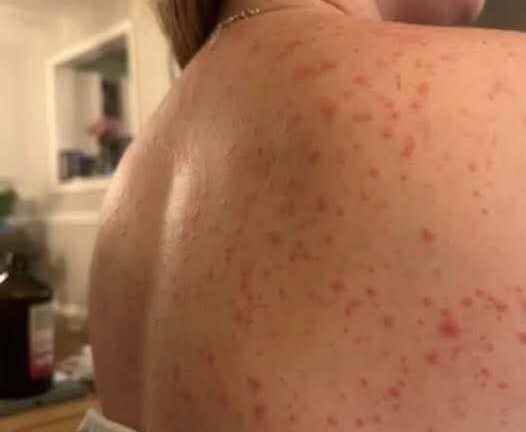 These are the consequences of sleeping with…See more