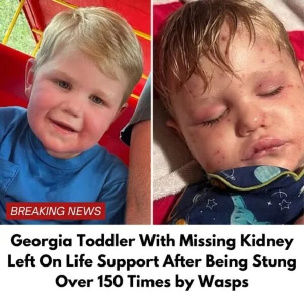 Georgia toddler stung over 150 times by yellow jackets, fighting for life
