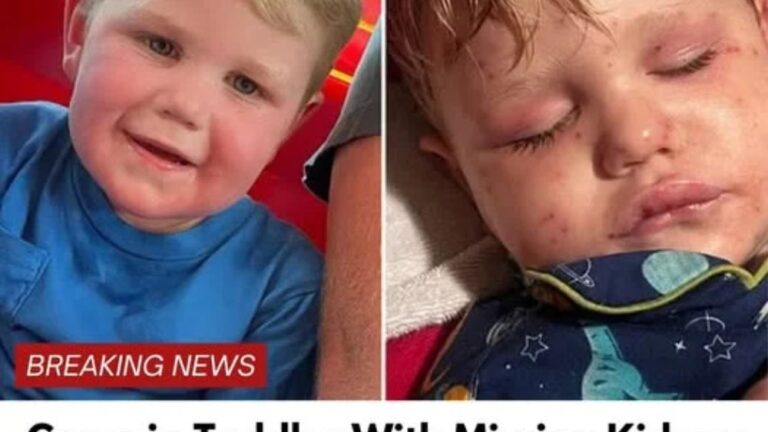 Georgia toddler stung over 150 times by yellow jackets, fighting for life
