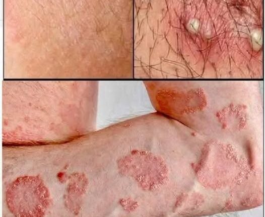 These are the signs that he is cr… See more