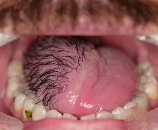 These are the consequences of eating …See more