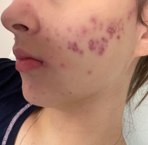 These are the consequences of sleeping with the…See more