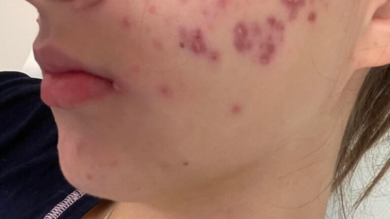 These are the consequences of sleeping with the…See more