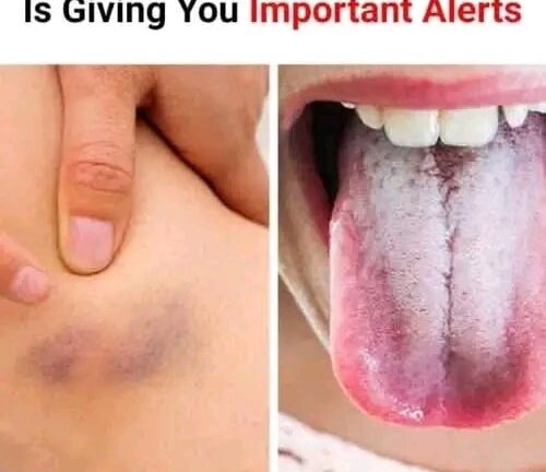 11 Signs Your Body Is Giving You Important Alerts