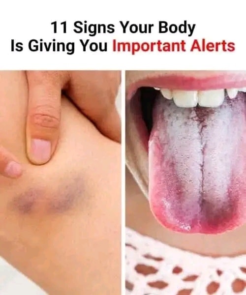 11 Signs Your Body Is Giving You Important Alerts