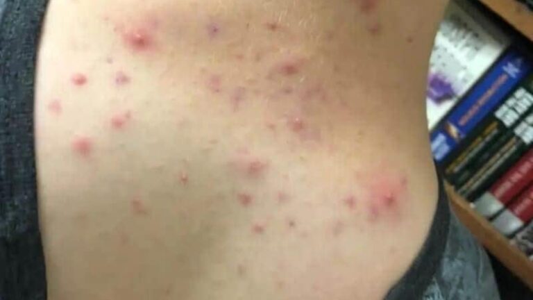 These are the consequences of sleeping with the…See more