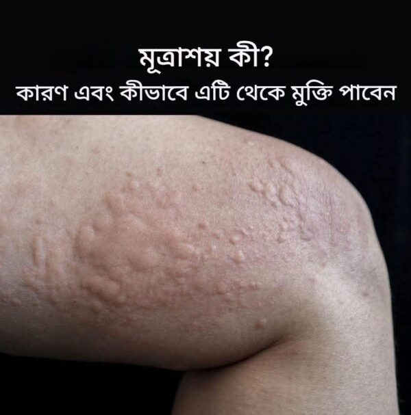 ত্বকের ফুসকুড়ির ধরণ