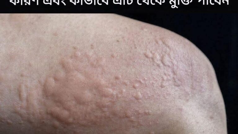 ত্বকের ফুসকুড়ির ধরণ