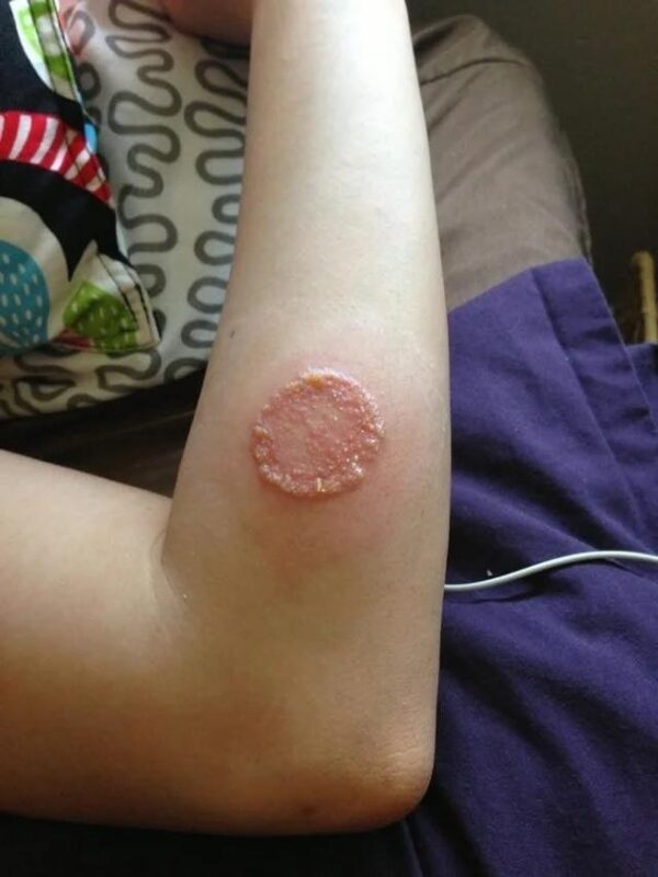 ALERT, These are the signs that it is cre, See more!!!