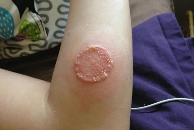 ALERT, These are the signs that it is cre, See more!!!