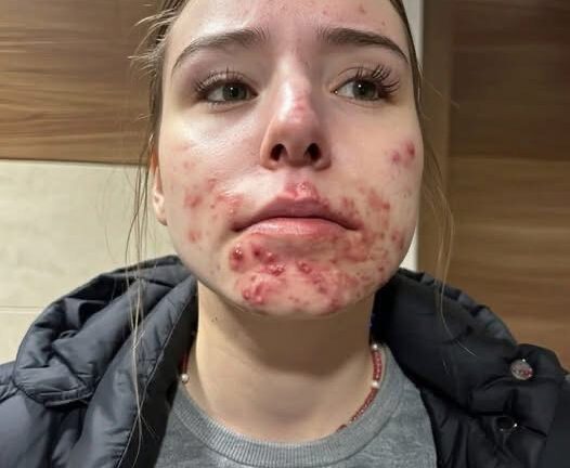 What Your Skin Could Be Telling You About Hidden Health Issues!